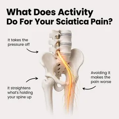 SootheSciatica ad: “What does activity do for your sciatica pain?” with a spine and hip illustration, second version