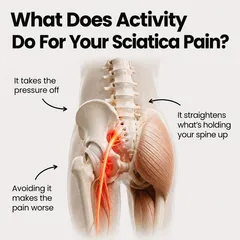 SootheSciatica ad: “What does activity do for your sciatica pain?” with an annotated spine and hip illustration
